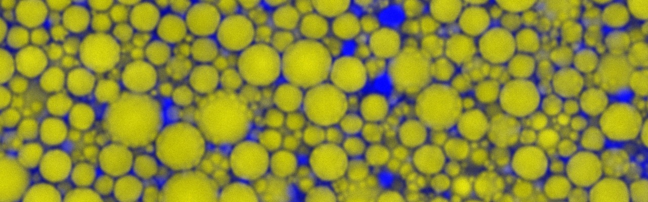 Mayonnaise seen through a microscope. Photo and colouring: Mathias Porsmose Clausen